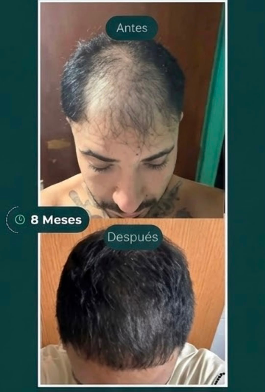 Resultado 3